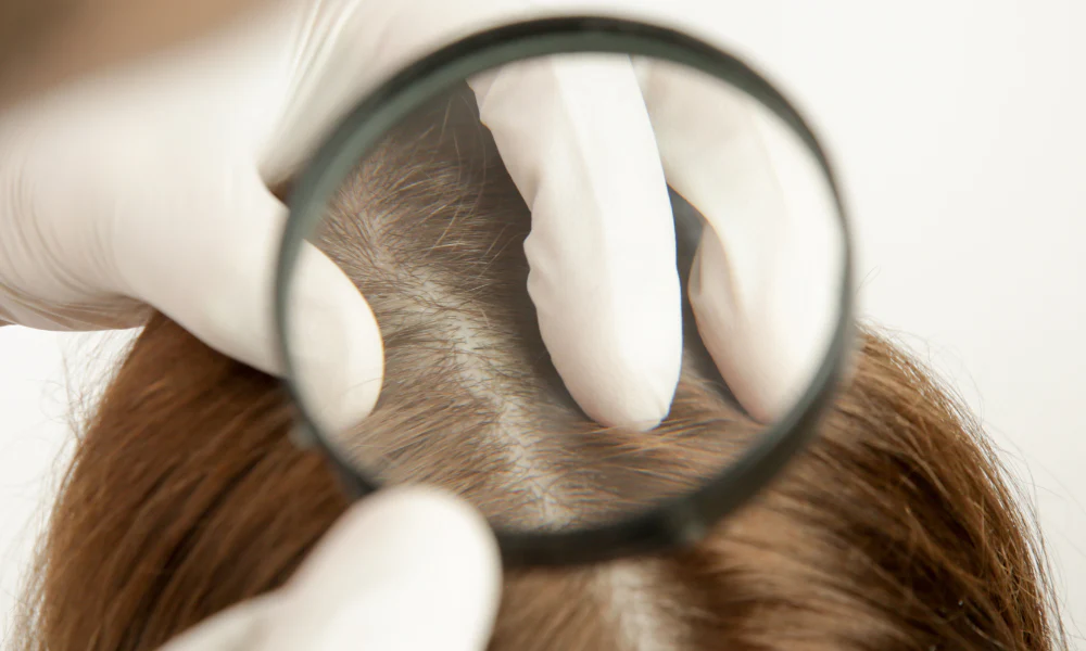 Close-up of healthy scalp through magnifying glass